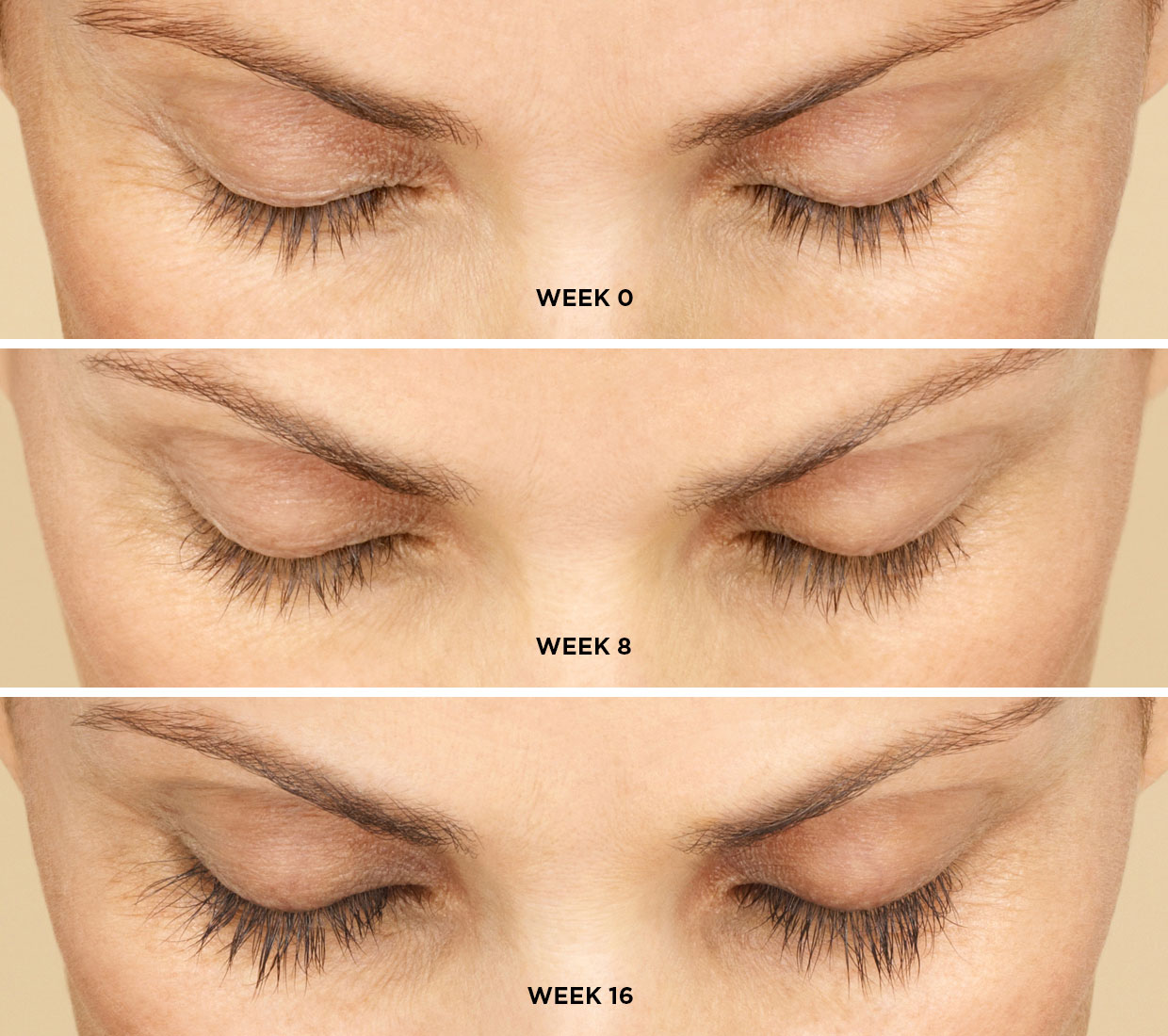 Latisse for Eyelash Growth – Synergy Medical Aesthetics – Nanaimo