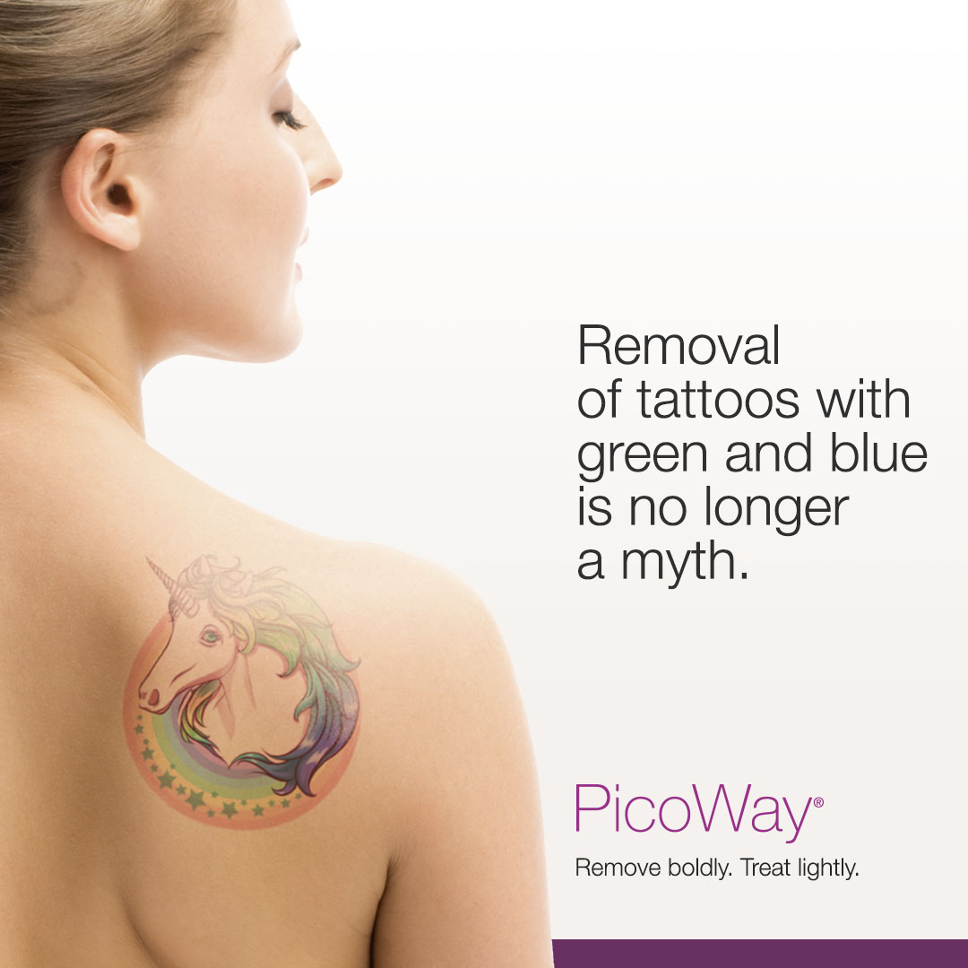 PicoLazer Tattoo Removal - Time for a Clear Canvas!