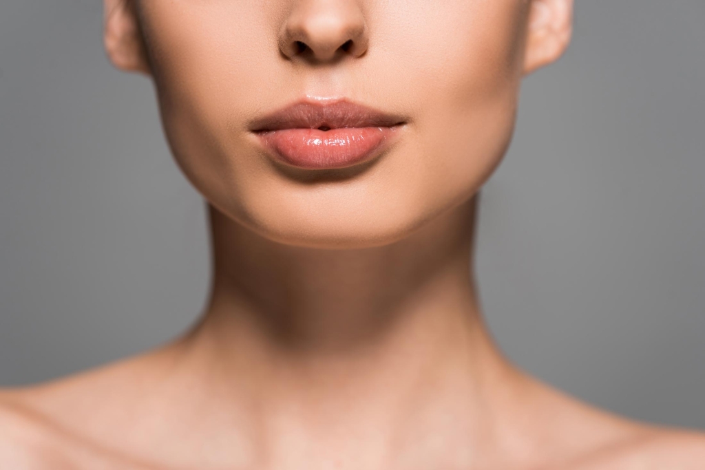 Lip Filler Synergy Medical Aesthetics Nanaimo, Victoria, Vancouver Island