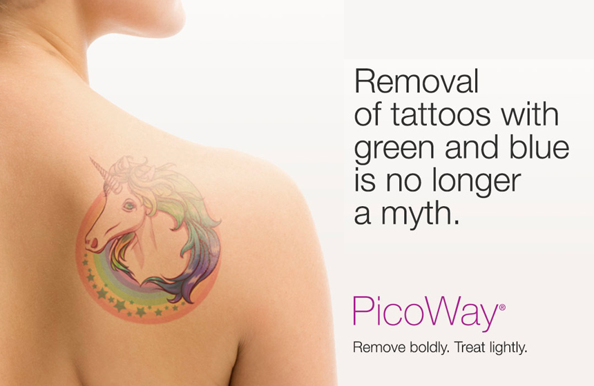 Expert Tattoo Removal NYC | Laser Tattoo Removal with PicoWay