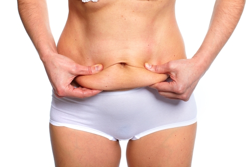 Tummy Tuck After C-Section: by Plastic Surgeon Dr. Phil Barnsley